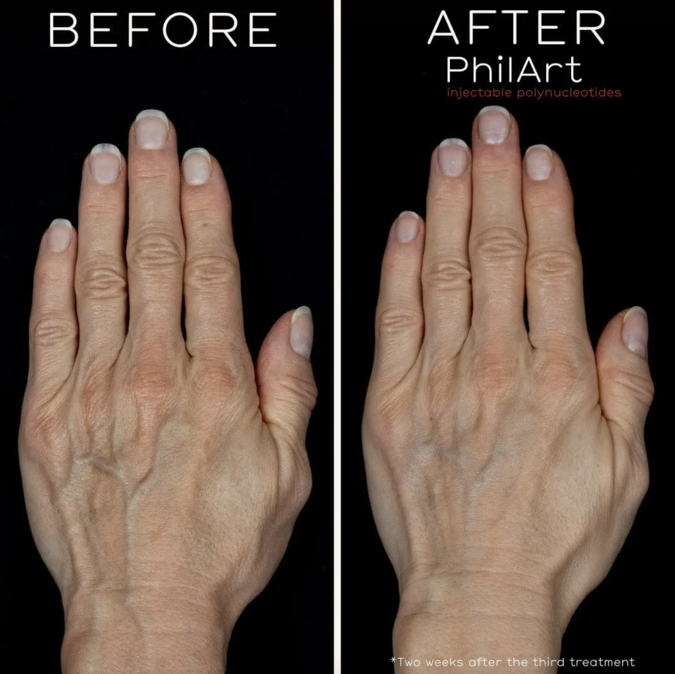 Bella egizaklar yalangoch Rus tilida uxlayotgan odamlar bilan jinsiy aloqa onlayn